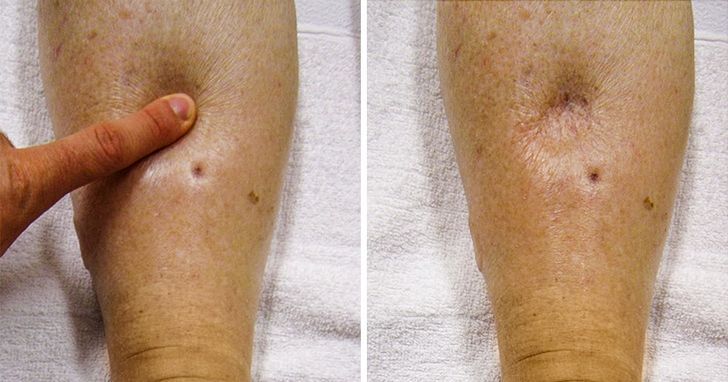 Cum să scapi de retenția de apă și să slăbești cu acești 5 pași simpli