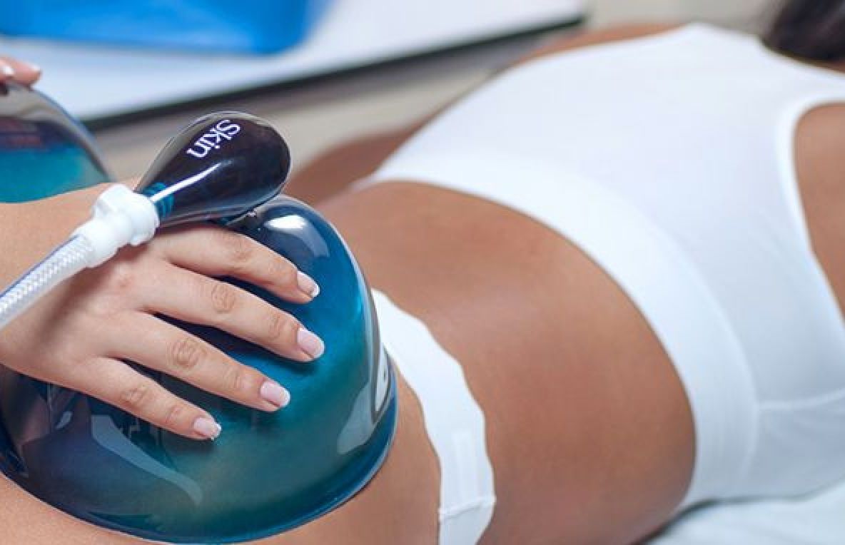 Lifting columbian: tehnica pentru fese curbate fără intervenție chirurgicală