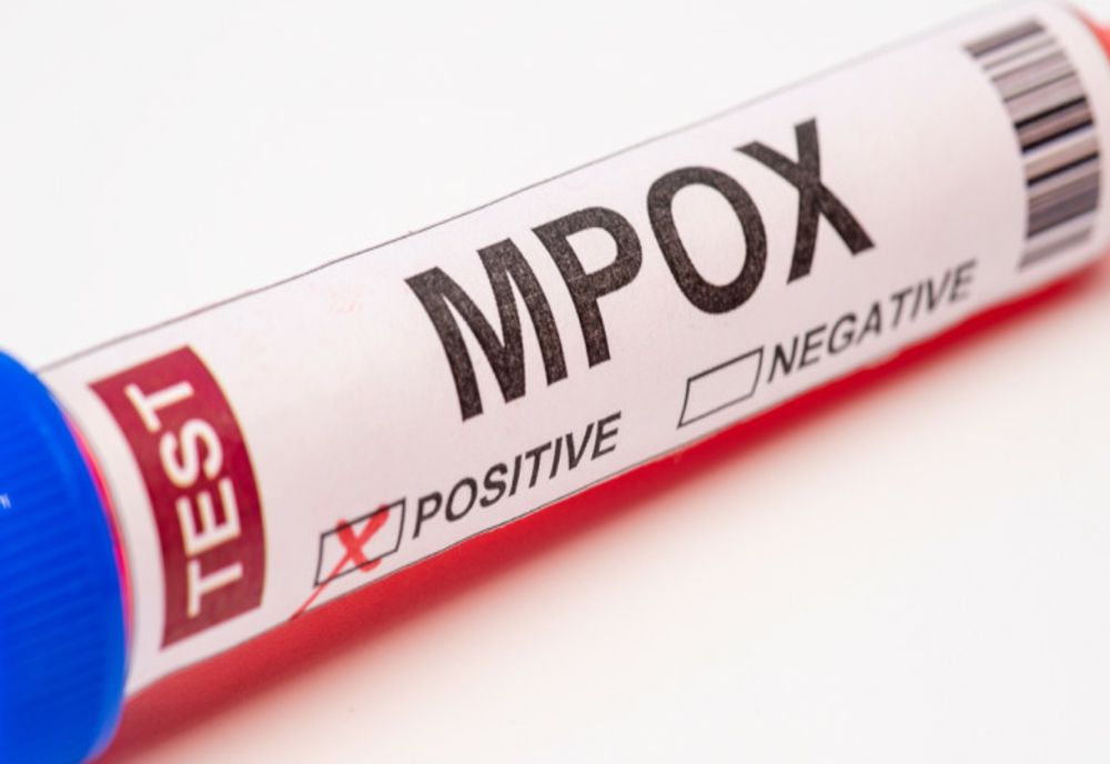 MPOX NU ESTE NOUL COVID, IATĂ DE CE!