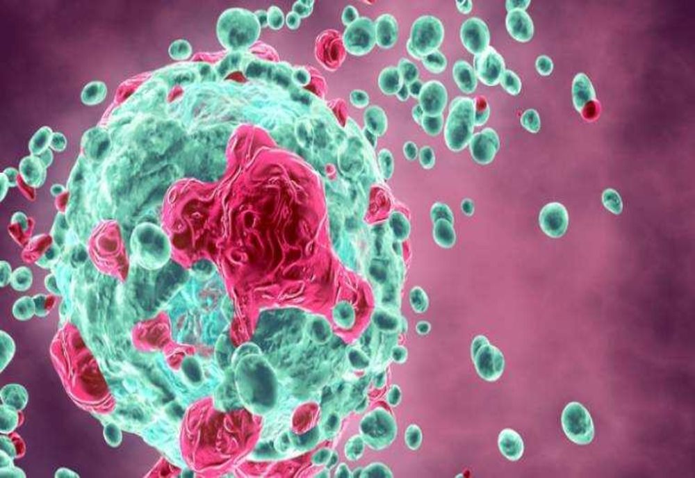 UN CANCER EXTREM DE RAR APARE TOT MAI DES LA PERSOANELE TINERE