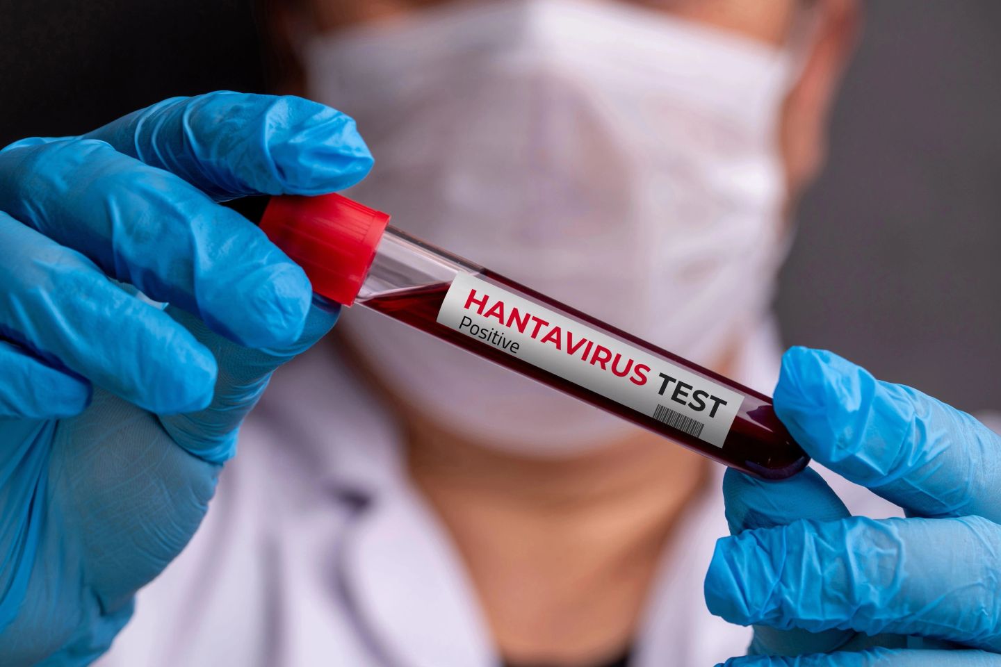 Recomandările OMS în cazul infectării cu hantavirus