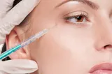 „Zombie filler”, procedura estetică ce stârnește controverse 