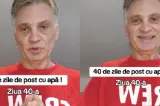 Artistul care a ținut post cu apă 40 de zile, operat de urgență