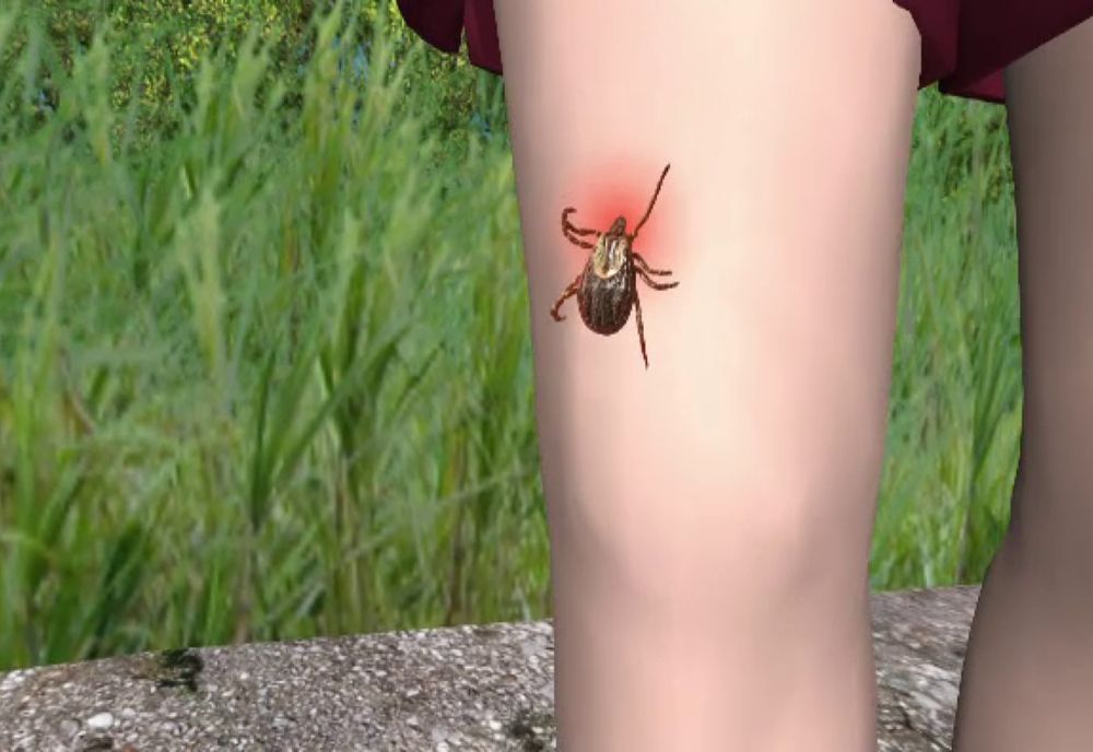 Cum te ferești de căpușe când ieși la iarbă verde și ce faci când ești mușcat