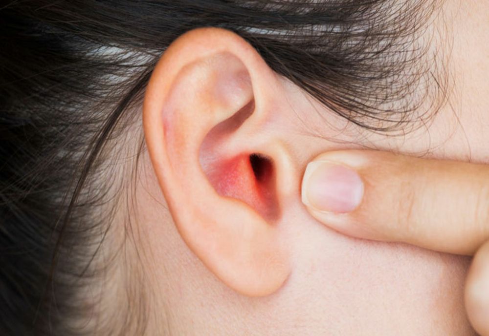 Afecțiunea urechii pe care o putem căpăta după înot