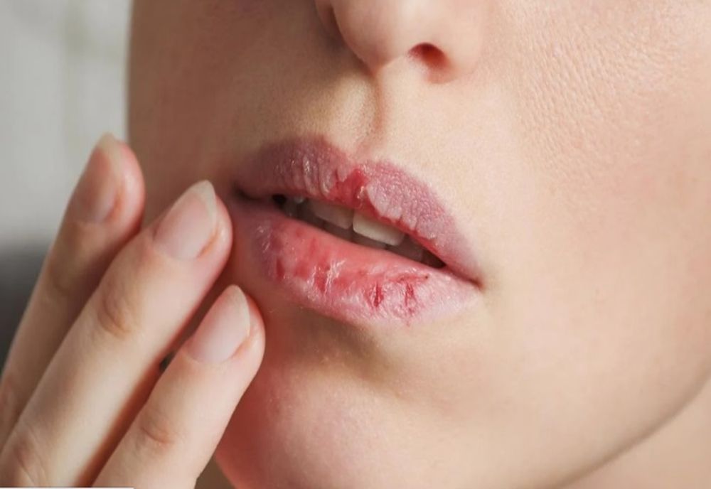 Amestecul din două ingrediente pentru buze uscate