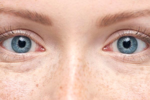 Indiciul de pe retină care-ți spune dacă prezinți un risc crescut de a suferi un atac de cord