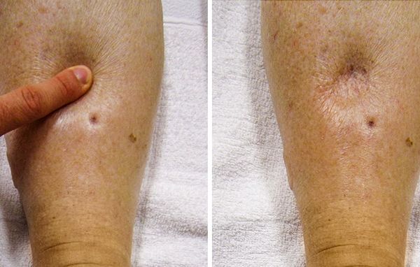 Cum să scapi de retenția de apă și să slăbești cu acești 5 pași simpli