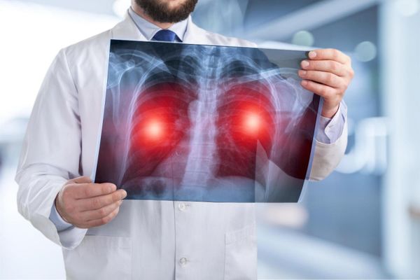 Vine cel mai mare val de bronșiolite din ultimii 10 ani. Pot fi afectați și adulții de boală?