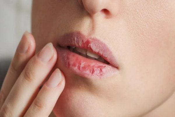 Amestecul din două ingrediente pentru buze uscate