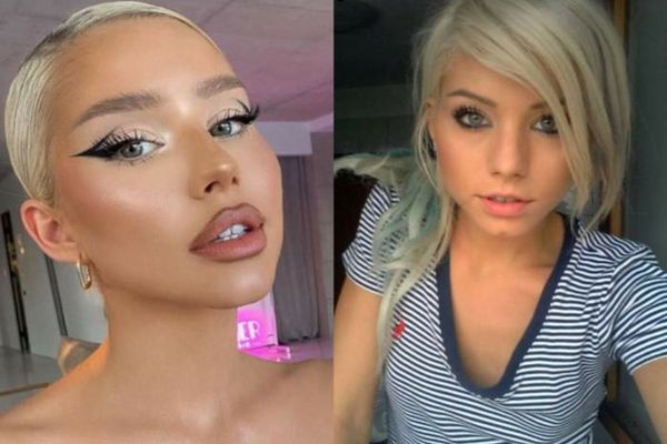 Carmen Grebenișan recunoaște fără reținere câte intervenții estetice are