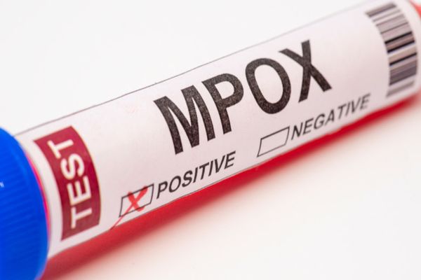 MPOX NU ESTE NOUL COVID, IATĂ DE CE!