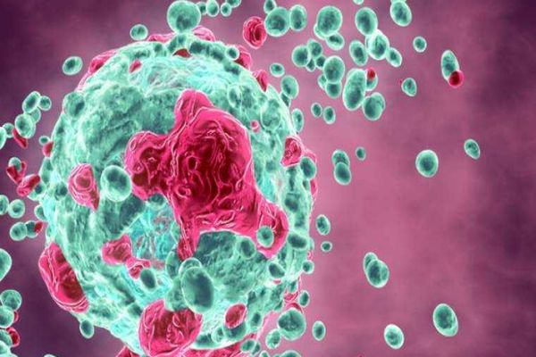 UN CANCER EXTREM DE RAR APARE TOT MAI DES LA PERSOANELE TINERE