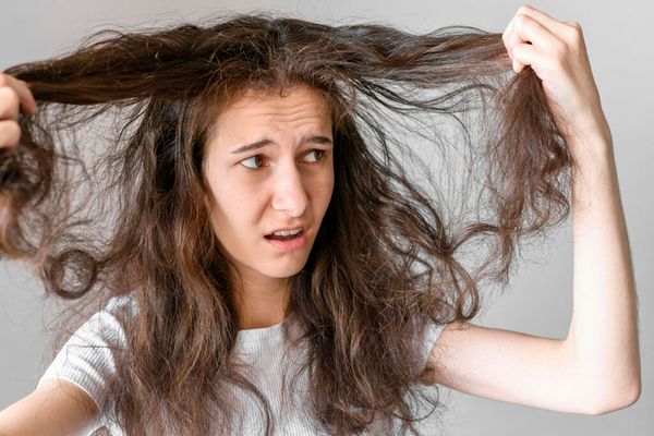 Scalp uscat și iritat: un dermatolog dezvăluie greșeala pe care o face toată lumea iarna