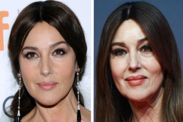 4 tipuri de îmbătrânire a pielii și cum să alegi rutina potrivită de îngrijire pentru fiecare