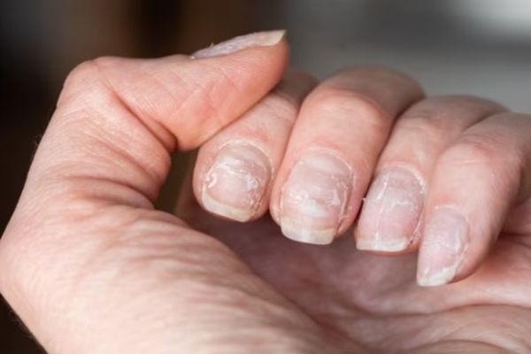 UNGHII MOI ȘI CASANTE: IATĂ CUM LE POȚI REPARA DUPĂ ÎNDEPĂRTAREA GELULUI SAU A OJEI SEMIPARMANENTE!